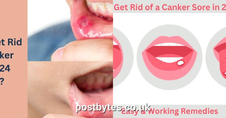 How to Get Rid of a Canker Sore in 24 Hours