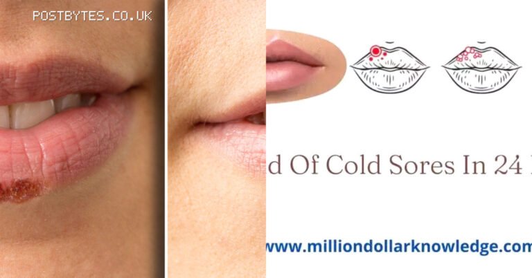 How to Get Rid of a Cold Sore in 24 Hours: What Actually Works