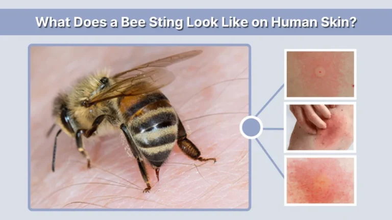What Does a Bee Sting Look Like? Visual Guide and Symptoms